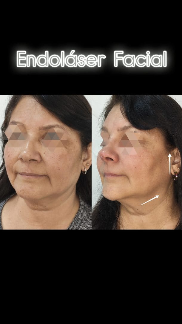 Post 6 by Estetic Berdent / Clinica Estetica Facial on Instagram (video)