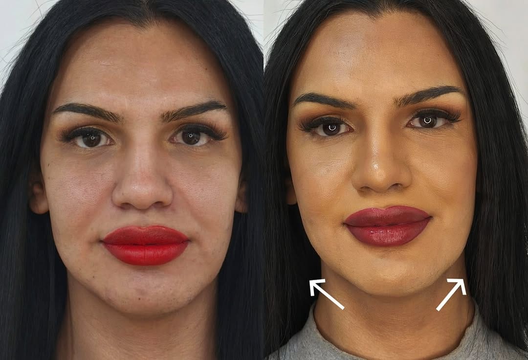 Post 8 by Estetic Berdent / Clinica Estetica Facial on Instagram (carousel)