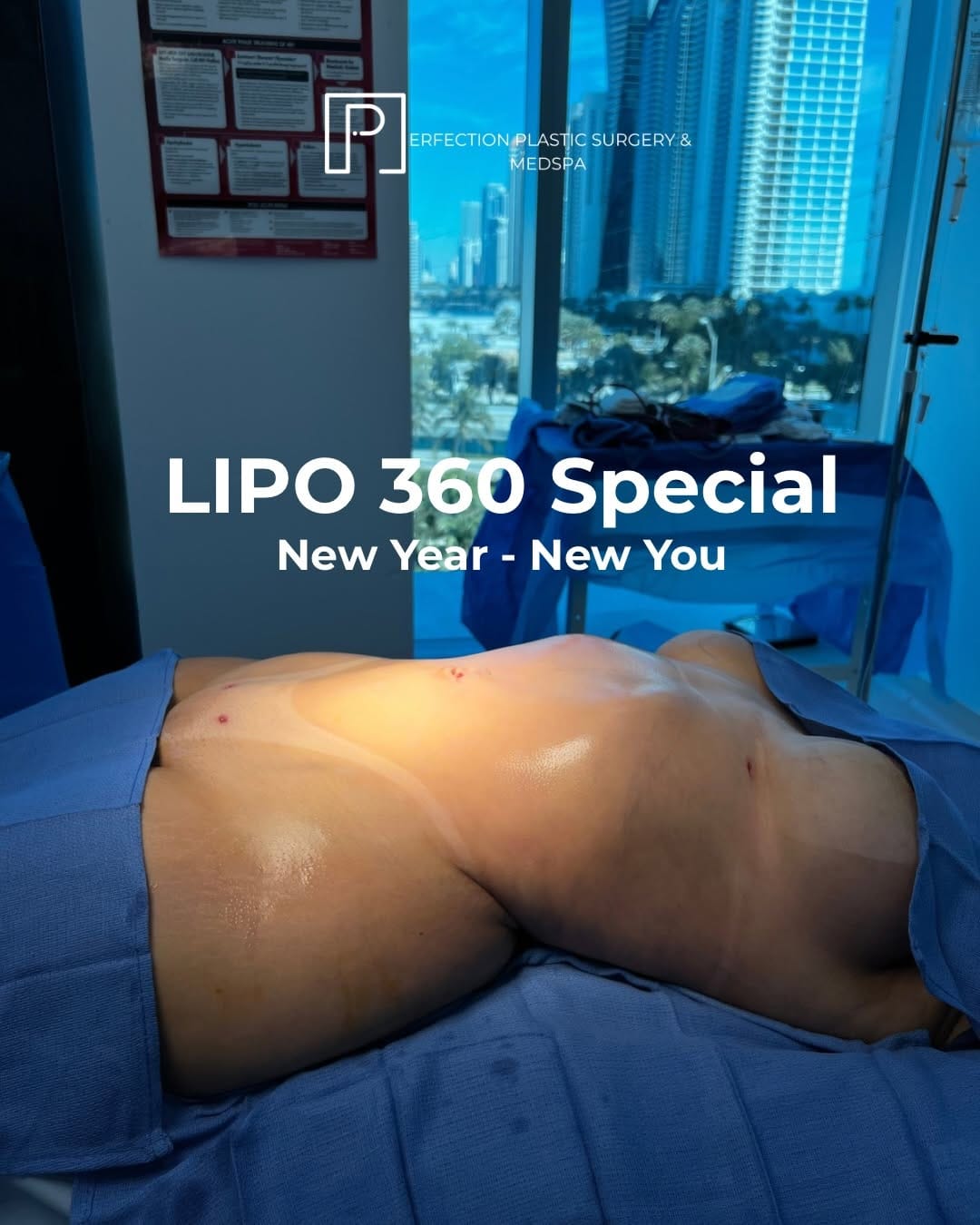 Post 8 by PERFECTION PLASTIC SURGERY & MED SPA on Instagram (carousel)
