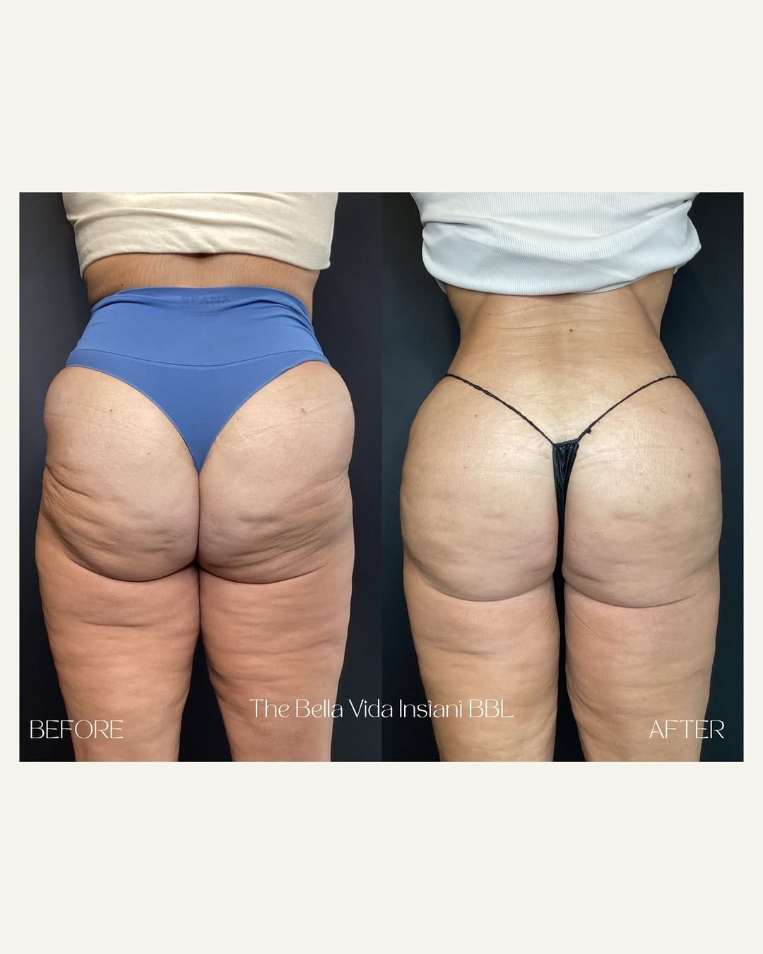 Post 4 by Bella Vida Aesthetics on Instagram (carousel)