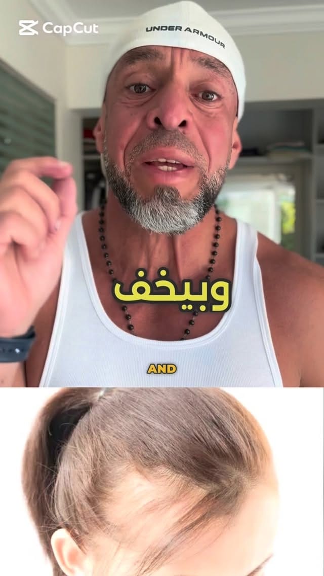 Post 7 by Dr.Ahmed Elkharashy on Instagram (video)