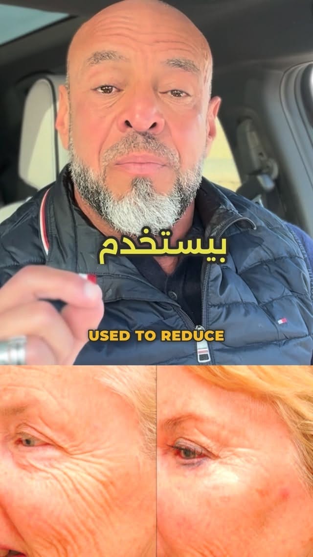 Post 5 by Dr.Ahmed Elkharashy on Instagram (video)