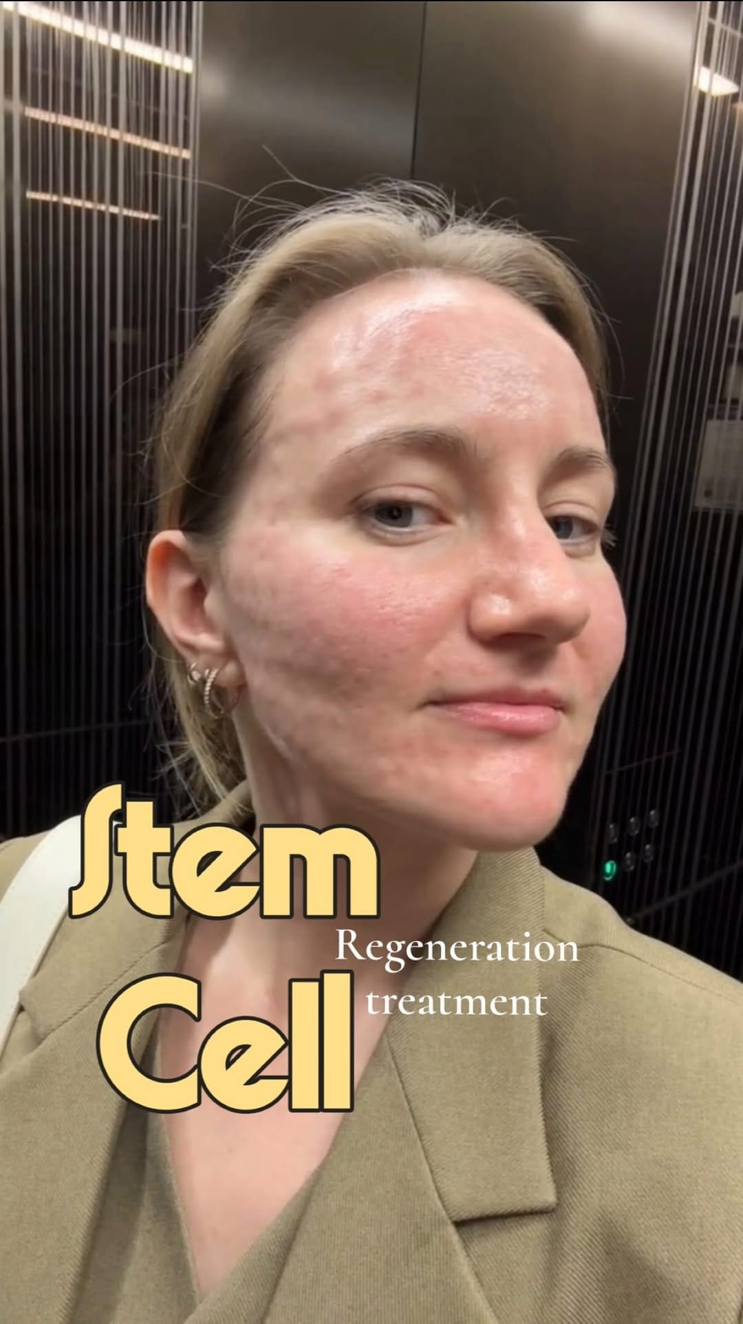 Post 2 by Liana Scott on Instagram (video)