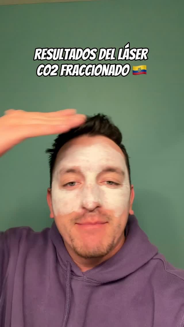 Post 2 by EcuaBro on Instagram (video)