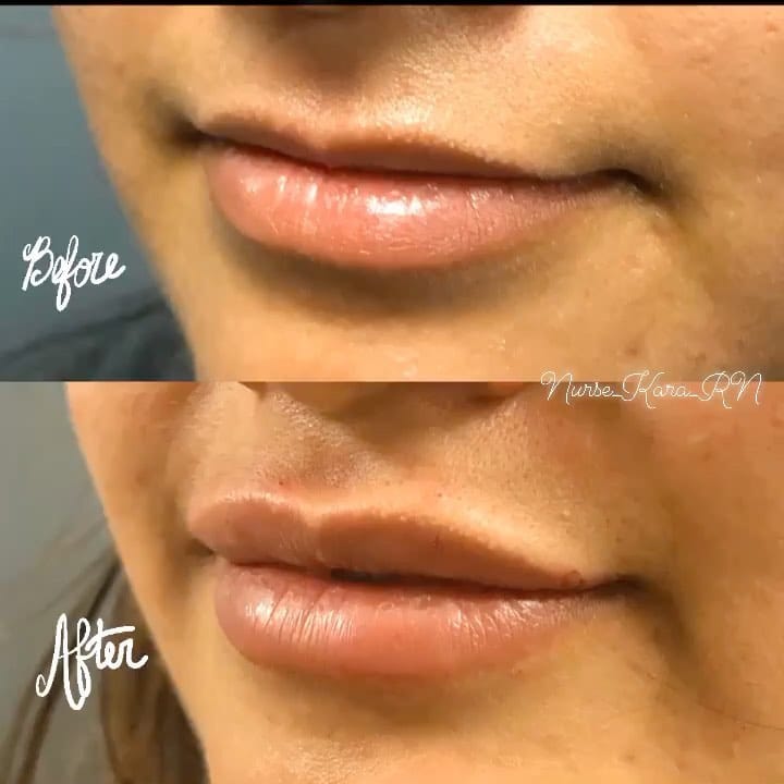 Post 3 by Nurse Kara RN BSN PHN MPH on Instagram (video)