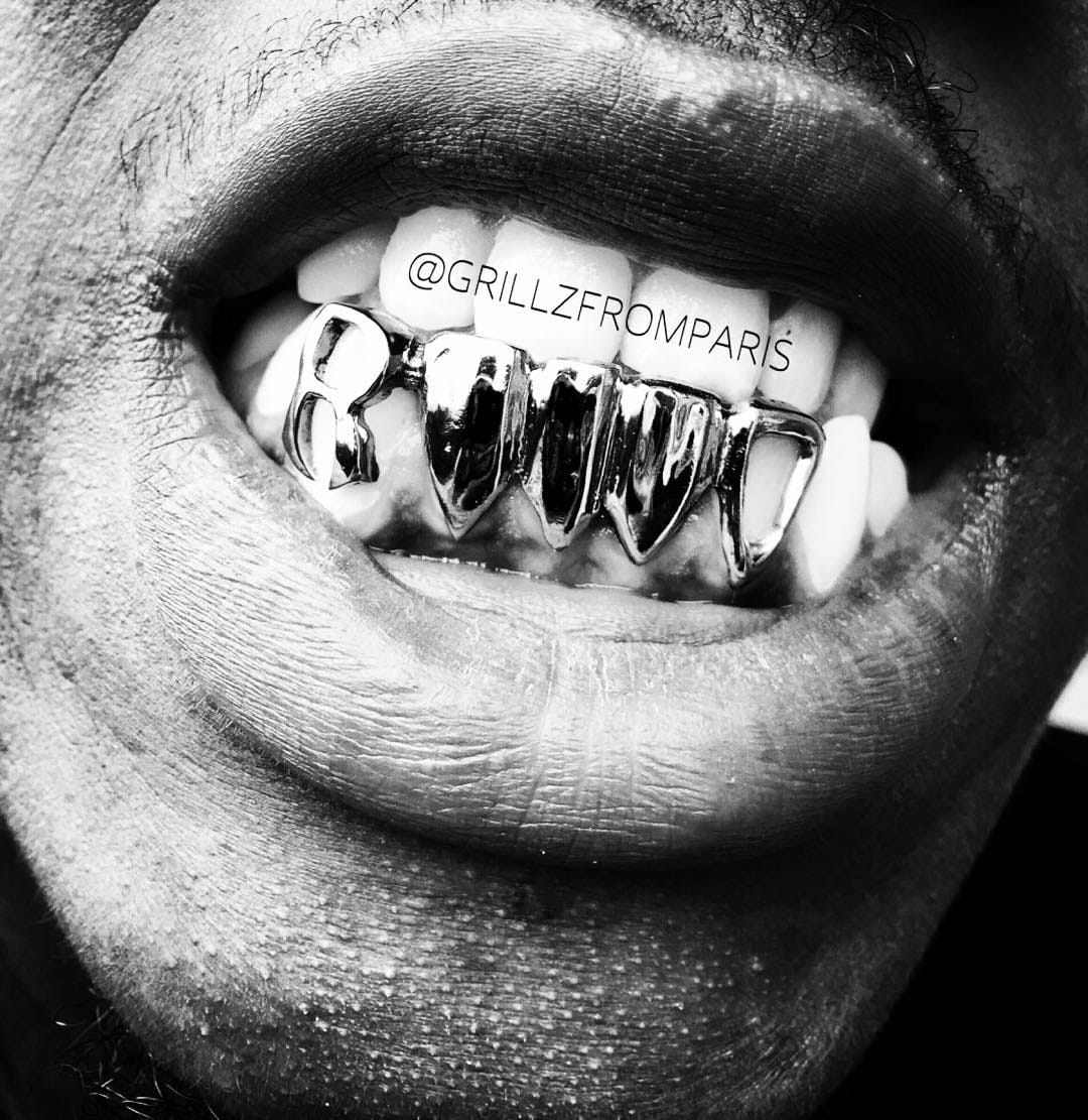 Post 8 by GrillzFromParis on Instagram (image)