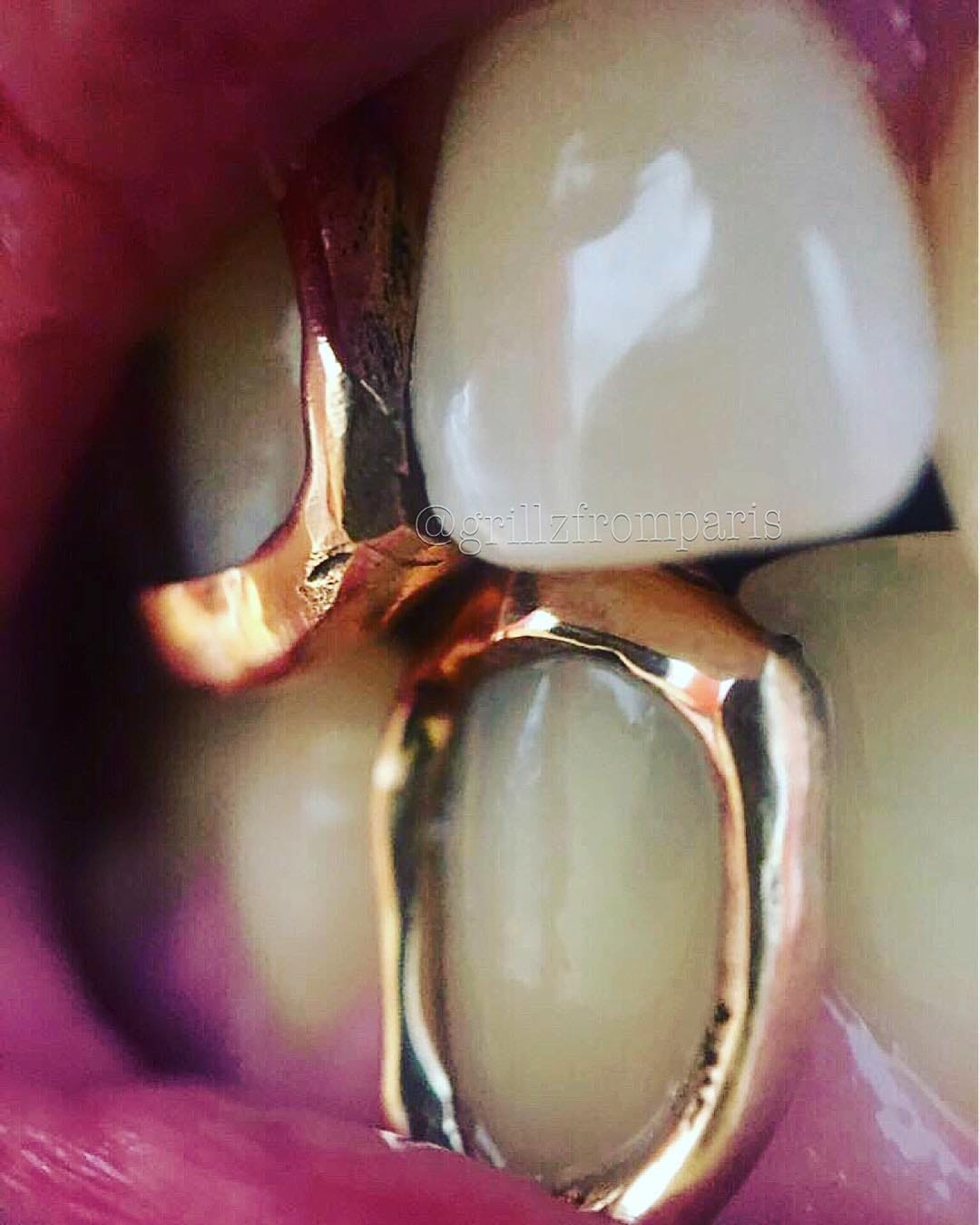 Post 6 by GrillzFromParis on Instagram (image)