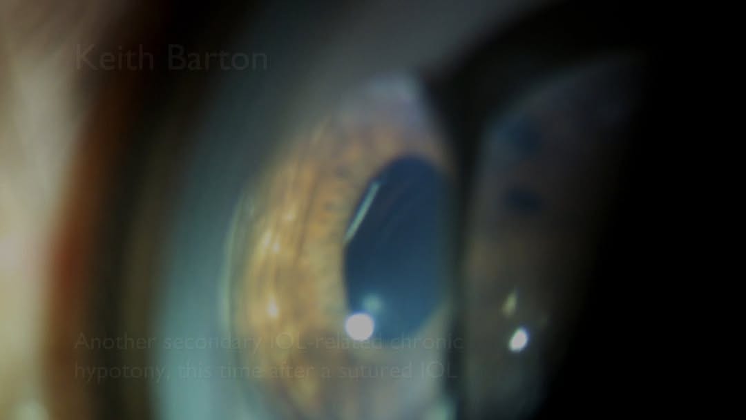 Post 1 by Keith Barton on Instagram (video)