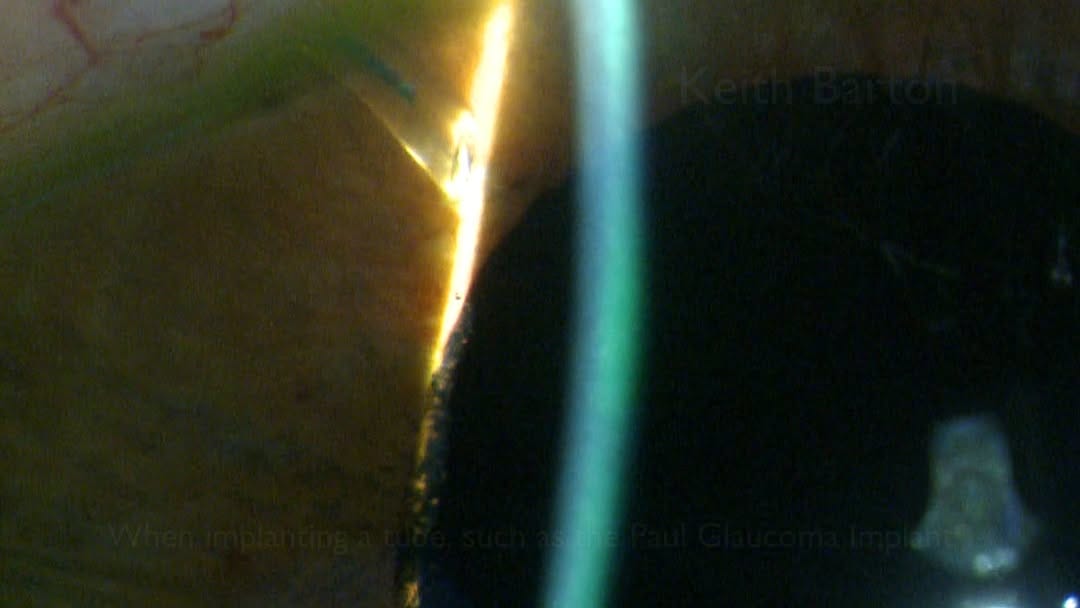 Post 2 by Keith Barton on Instagram (video)