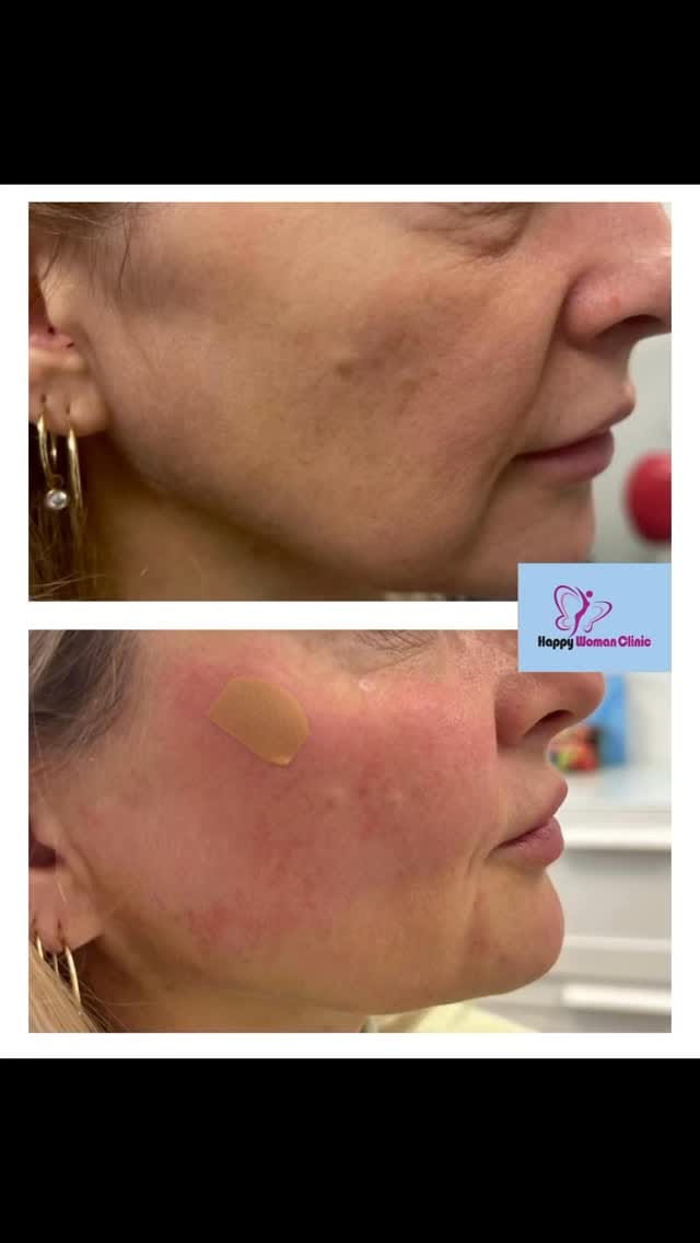 Post 8 by Happy Woman Clinic 0871878768 on Instagram (video)