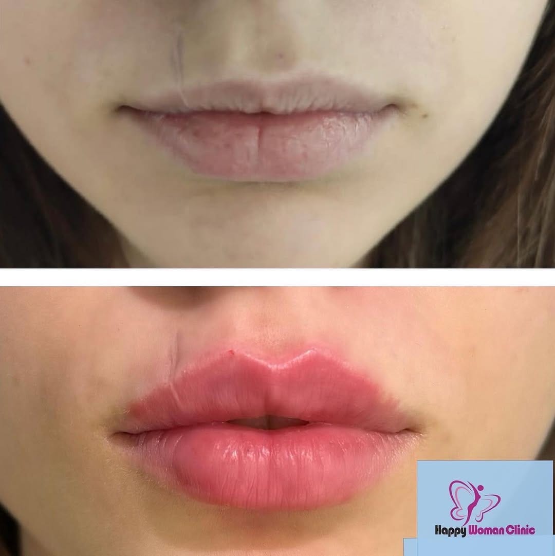 Post 10 by Happy Woman Clinic 0871878768 on Instagram (image)