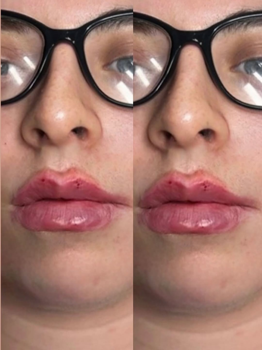 Post 1 by Aestheticsbysophia on Instagram (image)