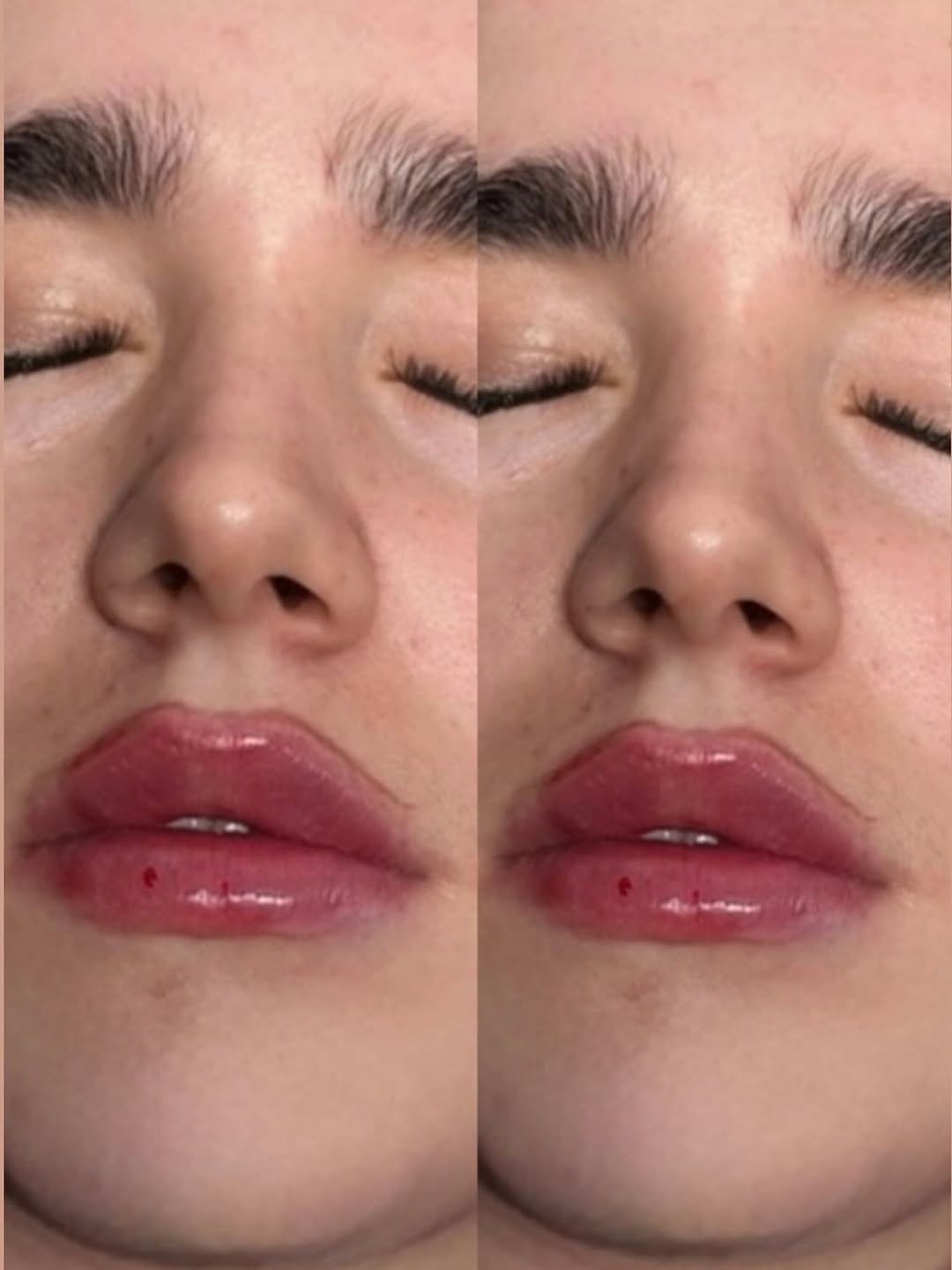 Post 6 by Aestheticsbysophia on Instagram (image)