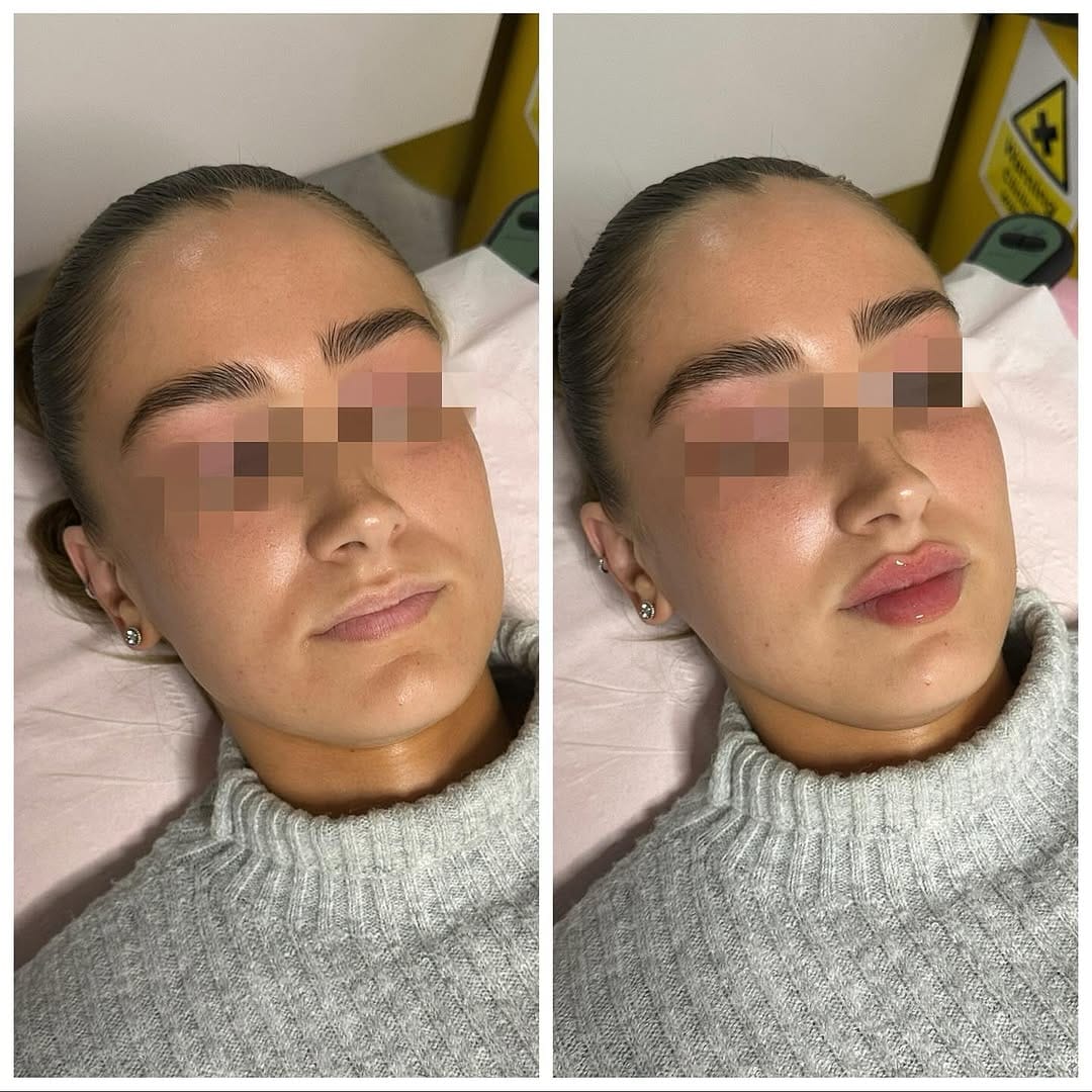 Post 7 by GLAM STUDIO CLINIC SURREY™ ♥ on Instagram (image)