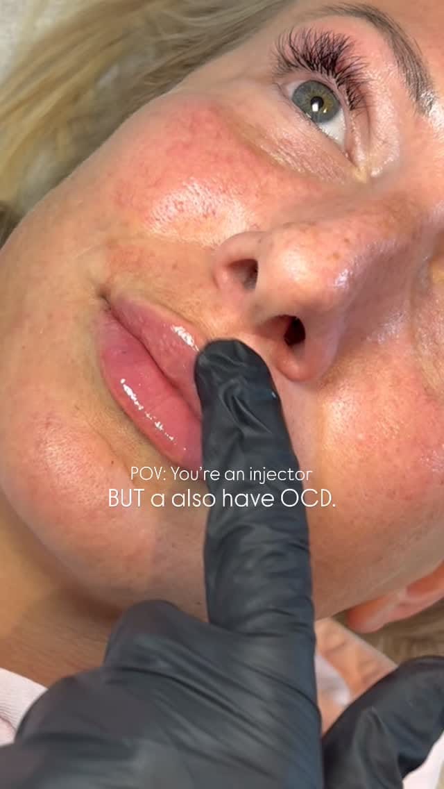 Post 5 by Abbey Marie | Filler | Facial Contouring | Skinboosters on Instagram (video)
