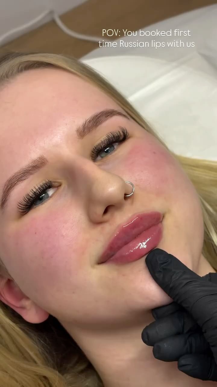 Post 2 by Abbey Marie | Filler | Facial Contouring | Skinboosters on Instagram (video)