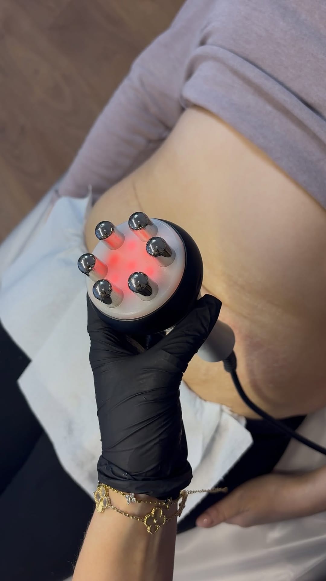 Post 4 by Abbey Marie | Filler | Facial Contouring | Skinboosters on Instagram (video)