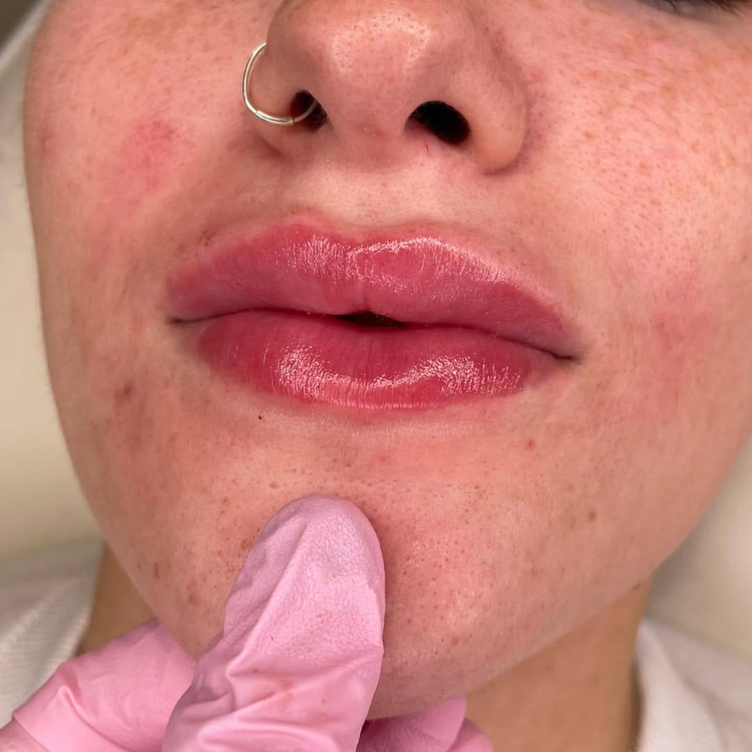 Post 8 by LASH ACADEMY & AESTHETIC PRACTITIONER on Instagram (carousel)