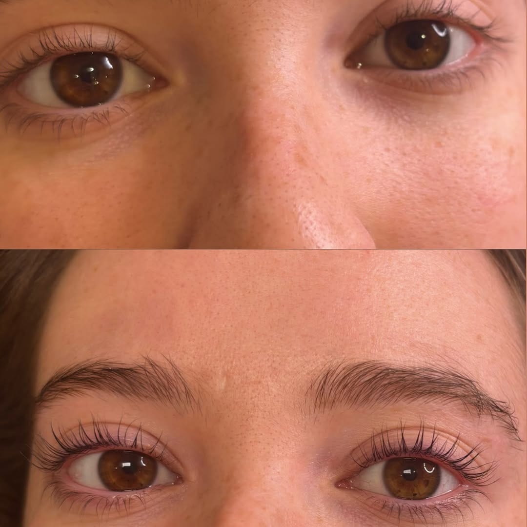 Post 7 by LASH ACADEMY & AESTHETIC PRACTITIONER on Instagram (image)