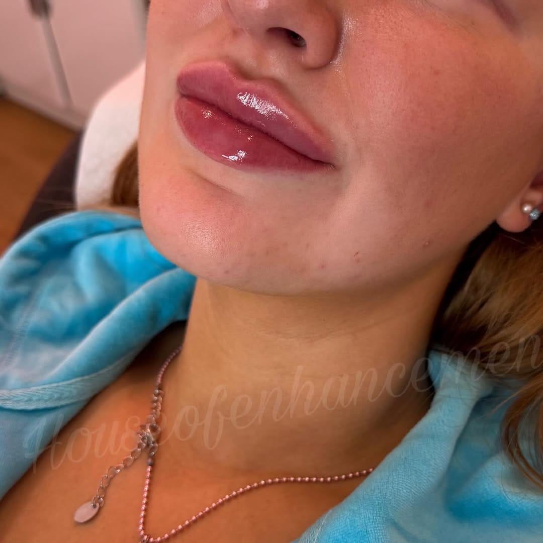 Post 2 by HouseofEnhancements ™️ on Instagram (image)