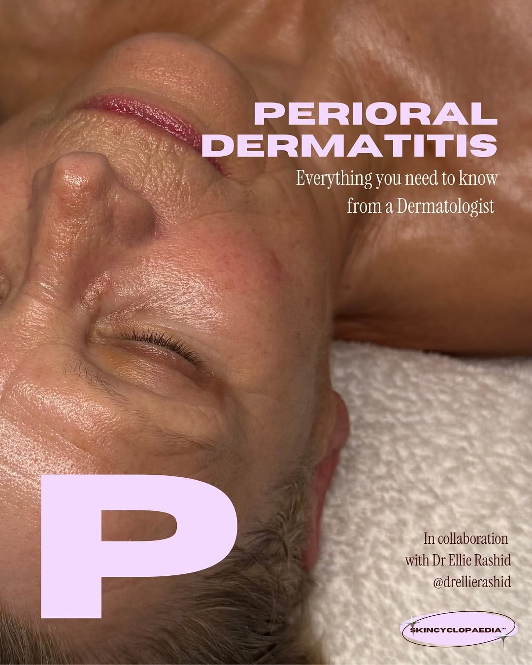Post 1 by Katie | Esthetician/Facialist + Skincare Educator on Instagram (carousel)
