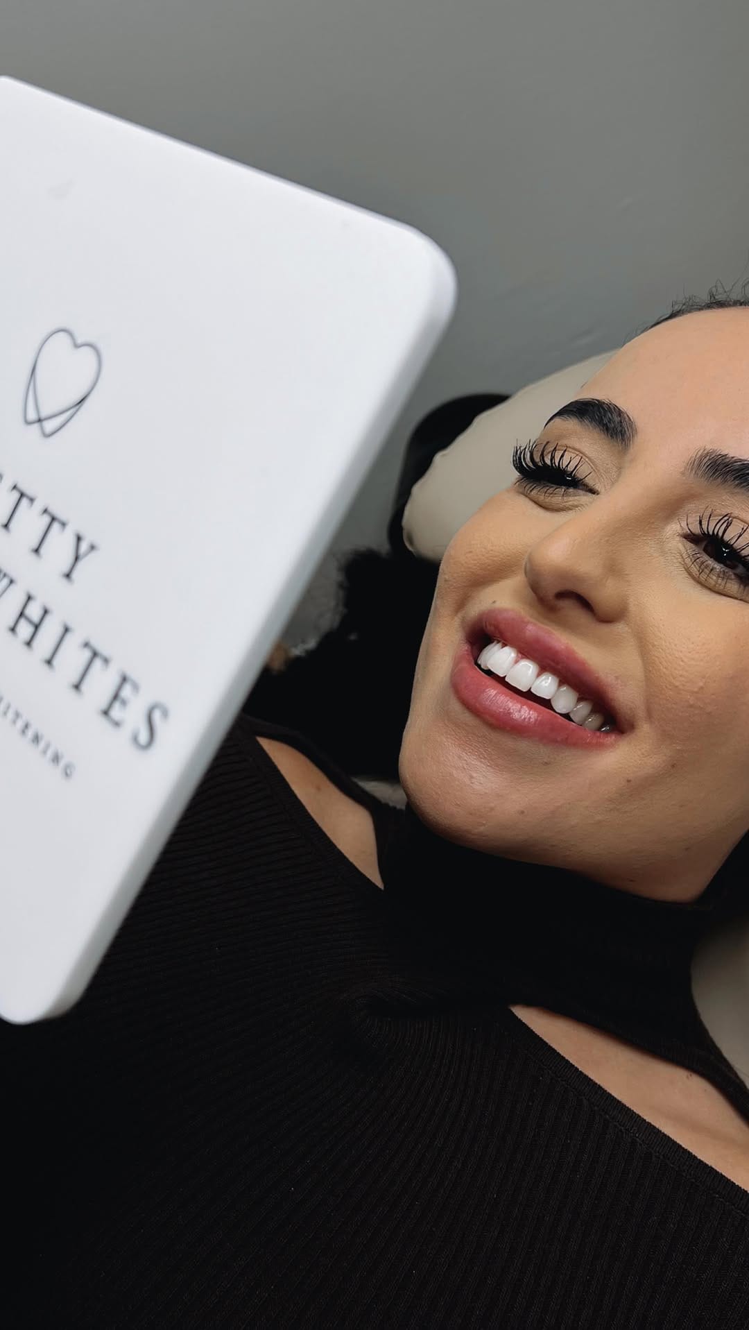 Post 7 by EMMA | MELBOURNES PROFESSIONAL TEETH WHITENING TECHNICIAN on Instagram (video)