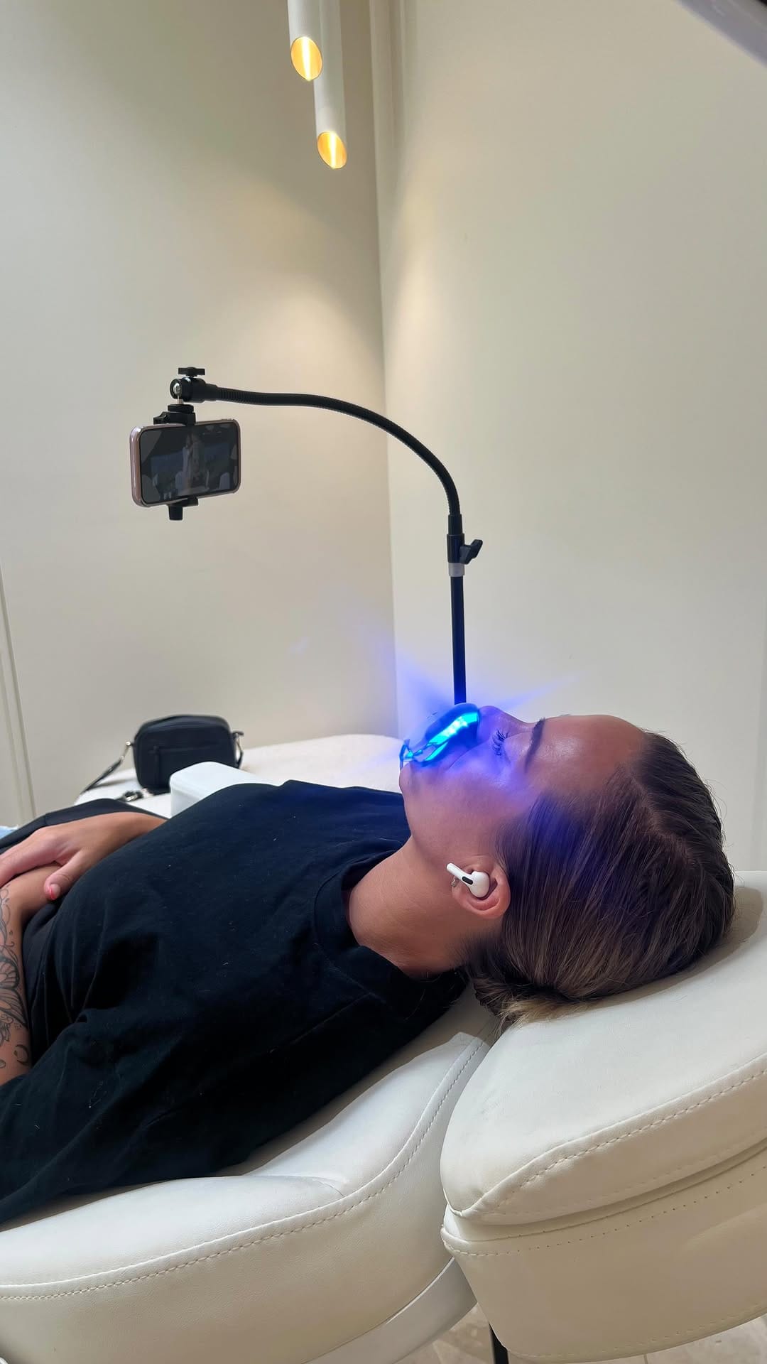 Post 8 by EMMA | MELBOURNES PROFESSIONAL TEETH WHITENING TECHNICIAN on Instagram (video)
