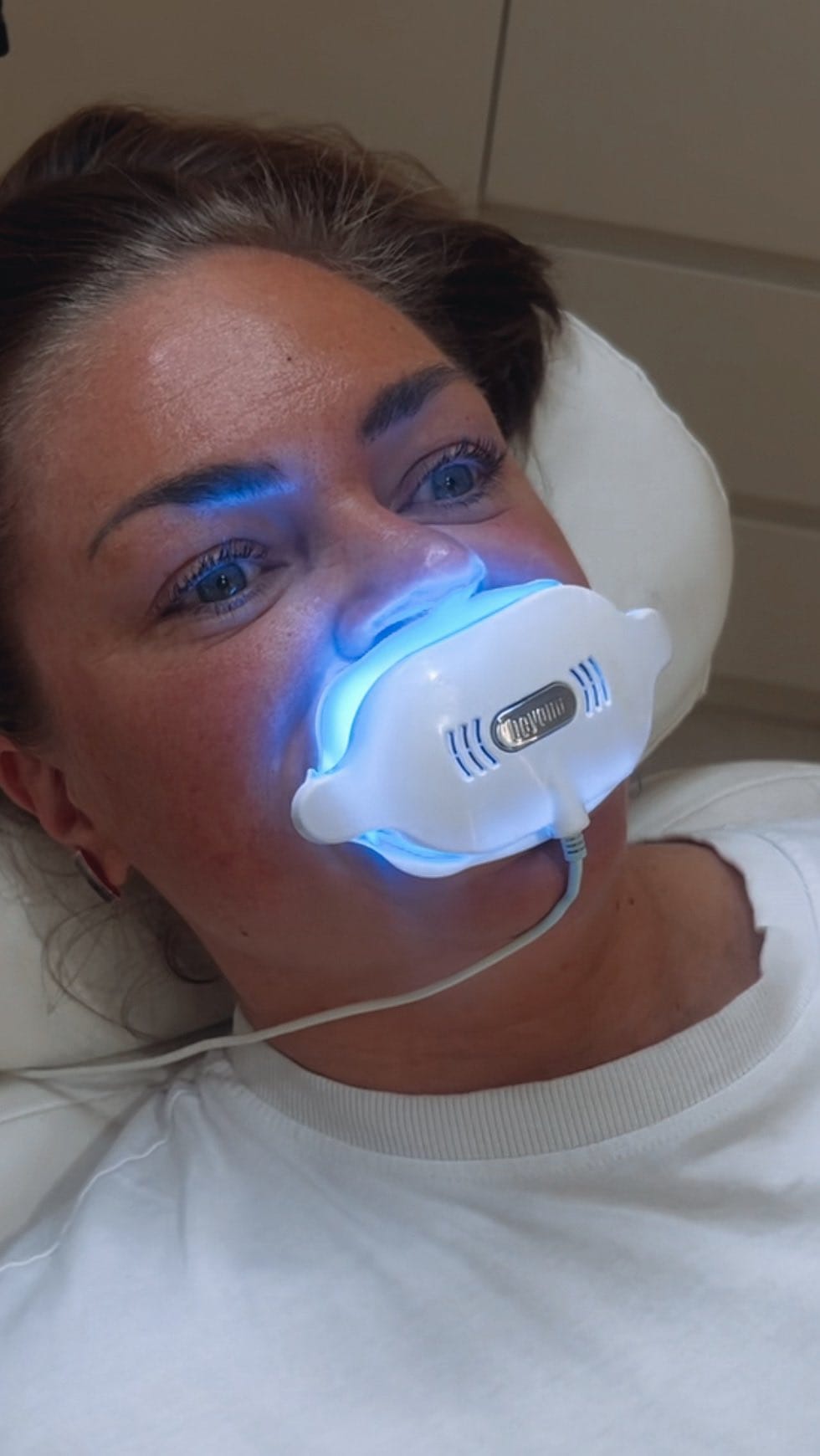 Post 6 by EMMA | MELBOURNES PROFESSIONAL TEETH WHITENING TECHNICIAN on Instagram (video)