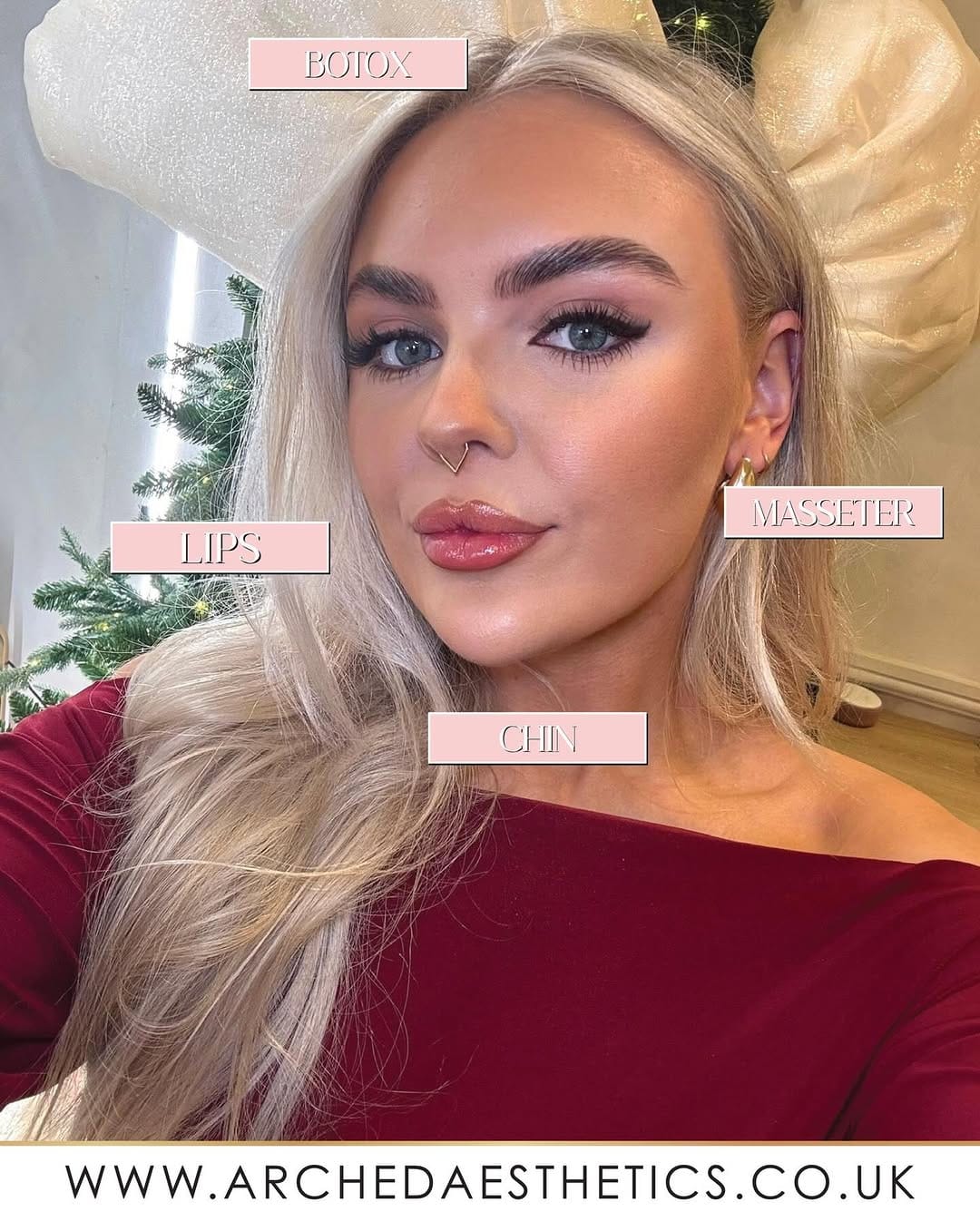 Post 3 by FACIAL AESTHETICS | PLYMOUTH & CORNWALL on Instagram (carousel)