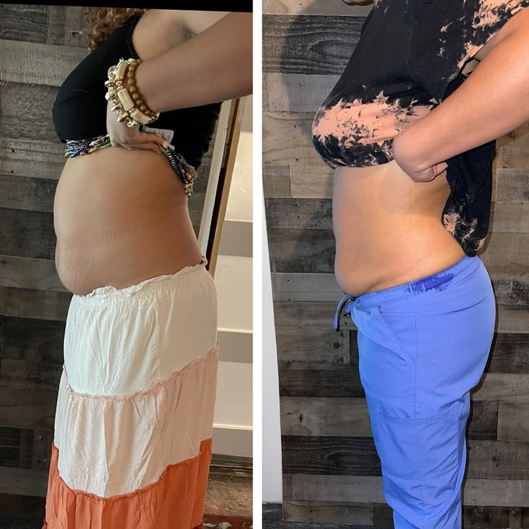 Post 4 by Designer Body Sculpting on Instagram (image)