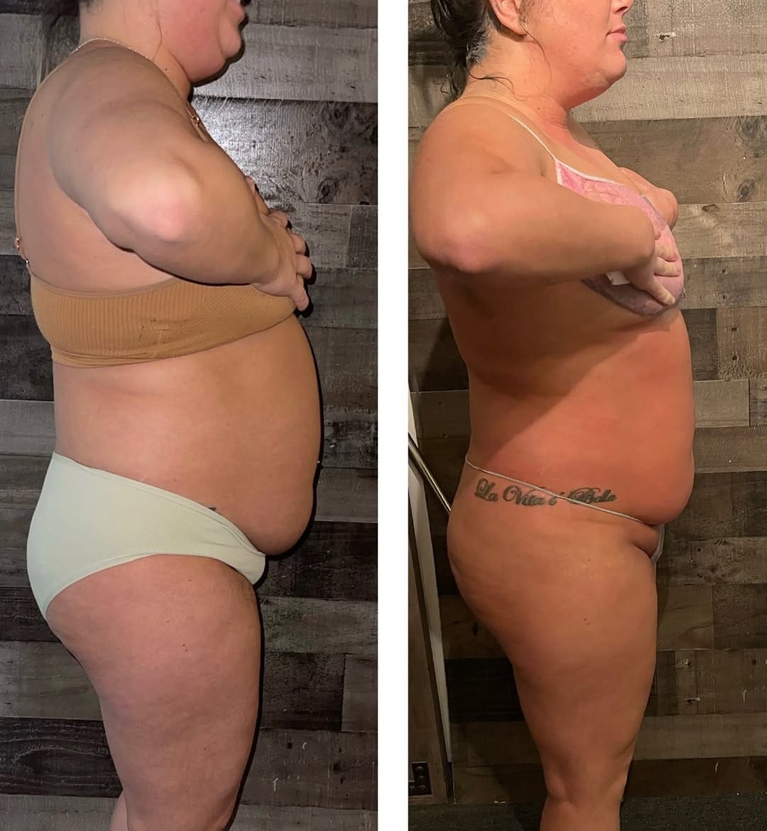 Post 7 by Designer Body Sculpting on Instagram (image)