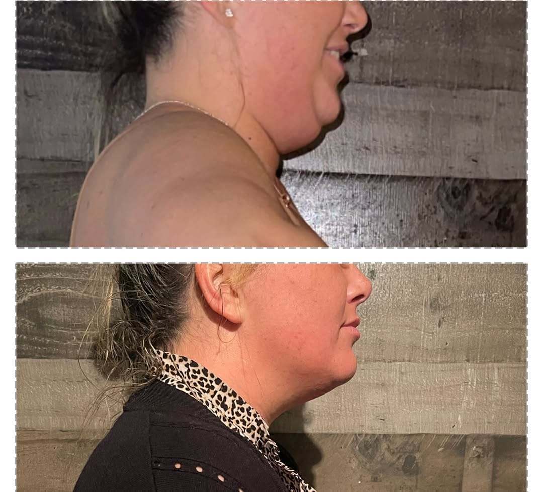 Post 6 by Designer Body Sculpting on Instagram (image)