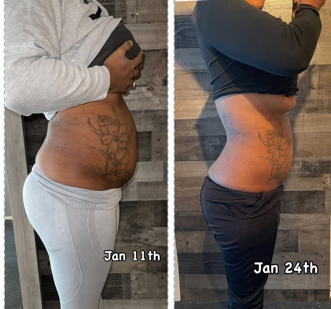 Post 5 by Designer Body Sculpting on Instagram (image)