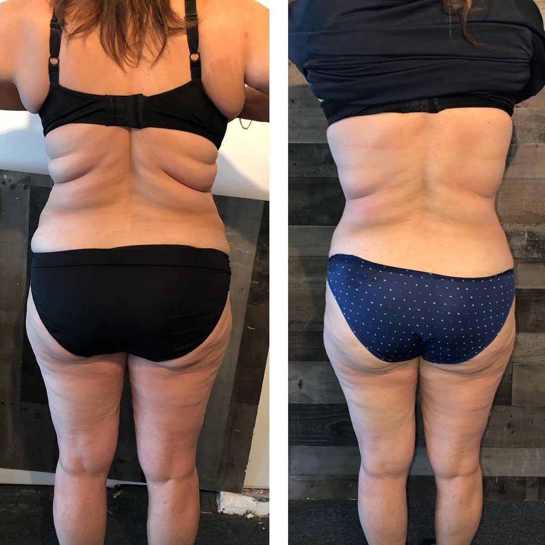 Post 9 by Designer Body Sculpting on Instagram (image)