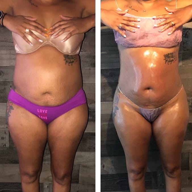 Post 8 by Designer Body Sculpting on Instagram (image)