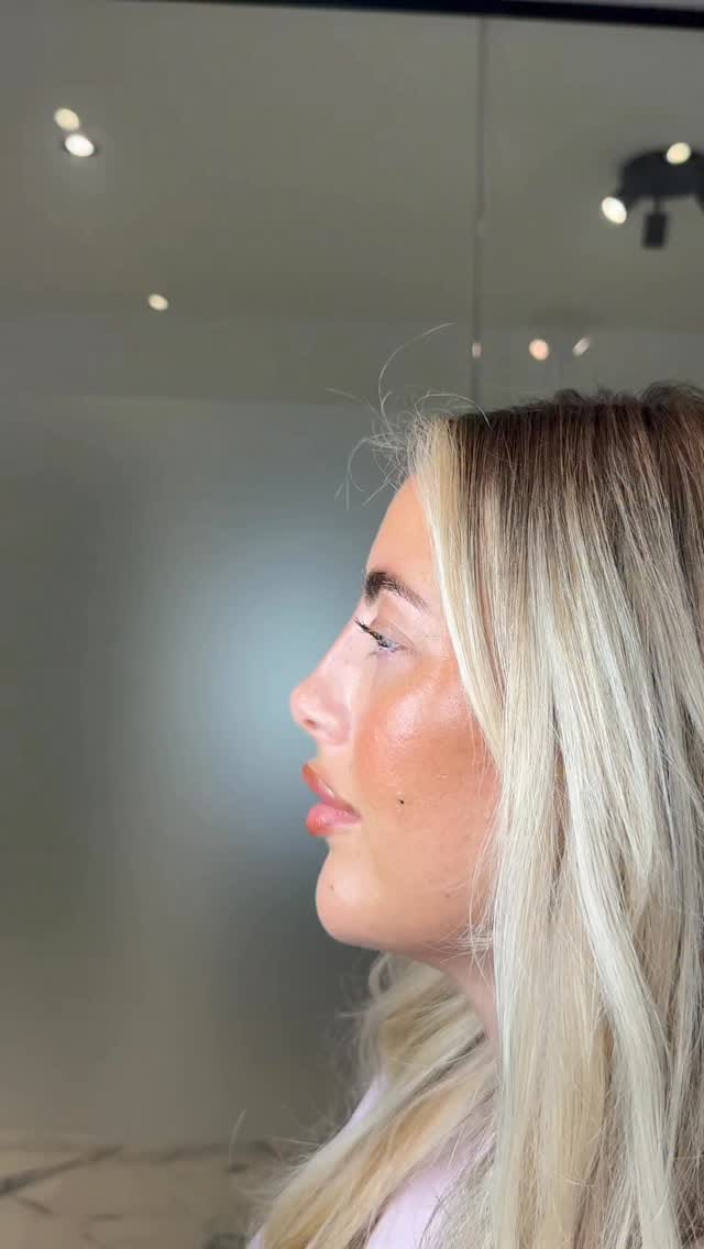 Post 4 by Surrey Aesthetics on Instagram (video)