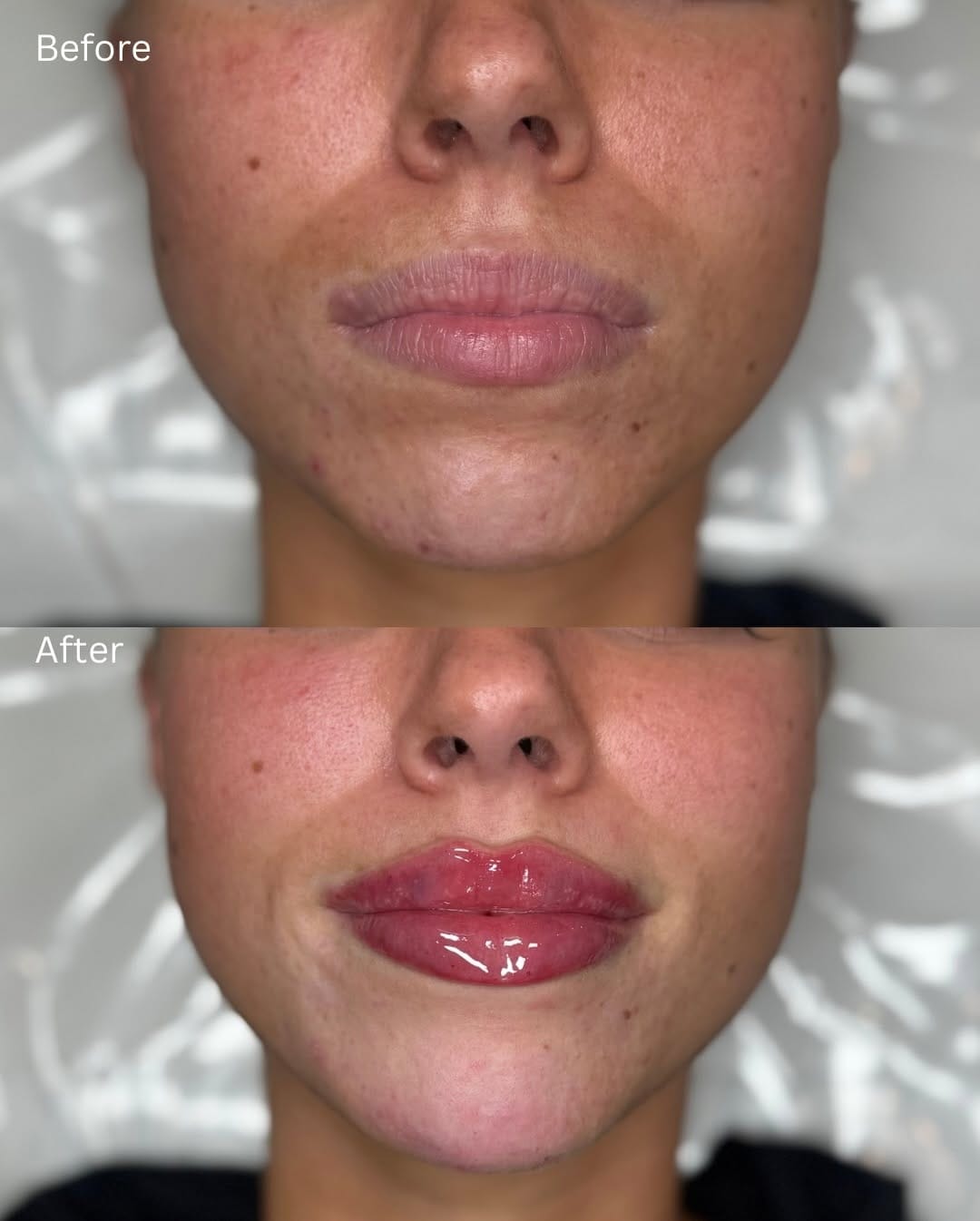 Post 6 by Surrey Aesthetics on Instagram (carousel)