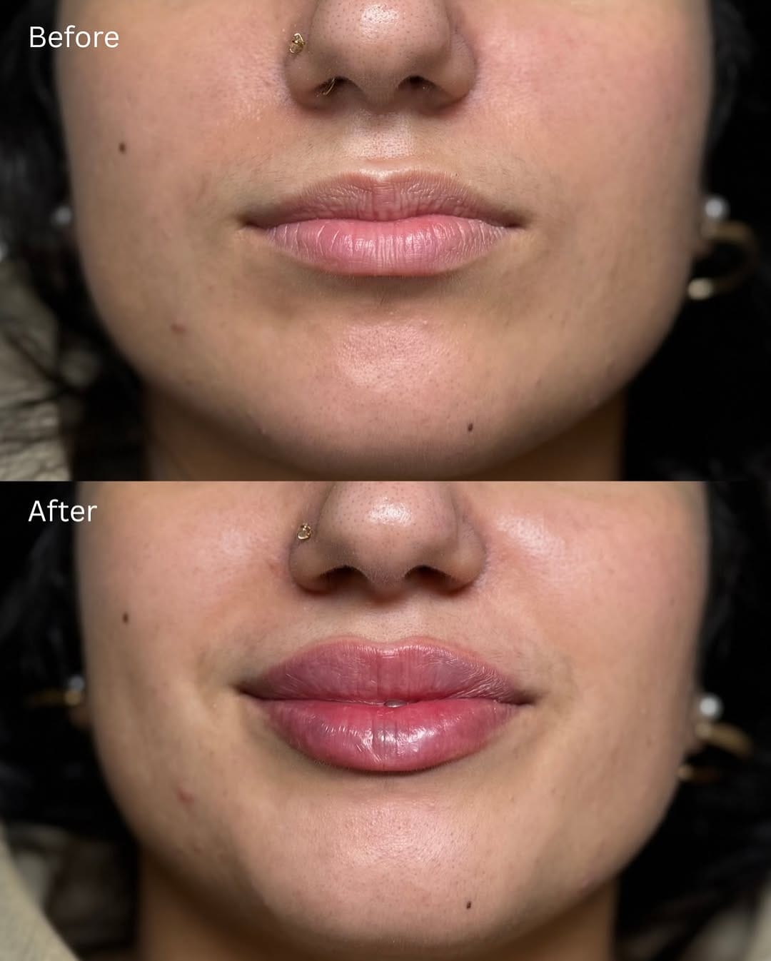 Post 8 by Surrey Aesthetics on Instagram (image)