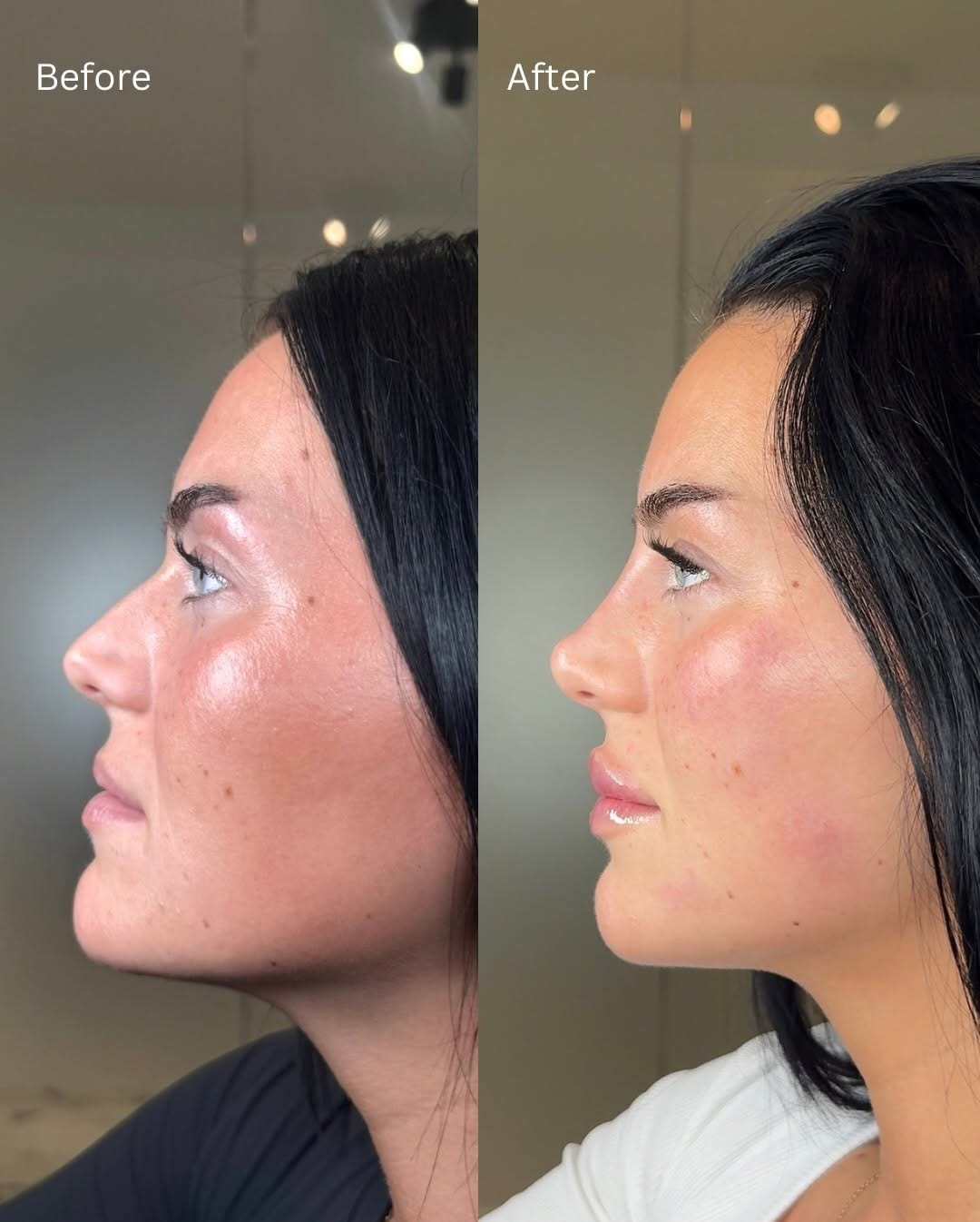 Post 9 by Surrey Aesthetics on Instagram (carousel)