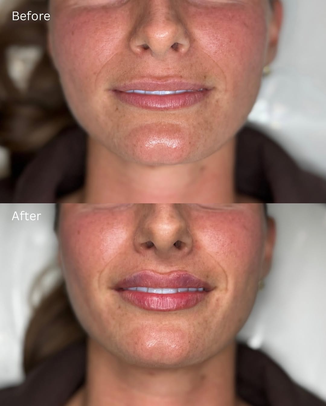 Post 1 by Surrey Aesthetics on Instagram (image)