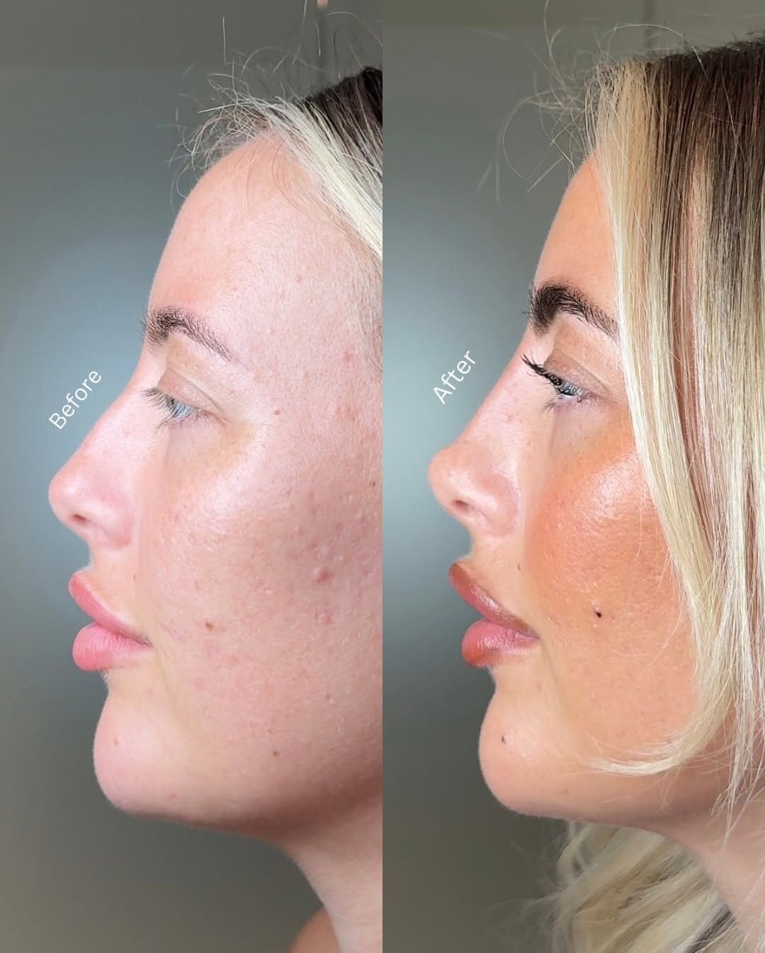 Post 5 by Surrey Aesthetics on Instagram (carousel)