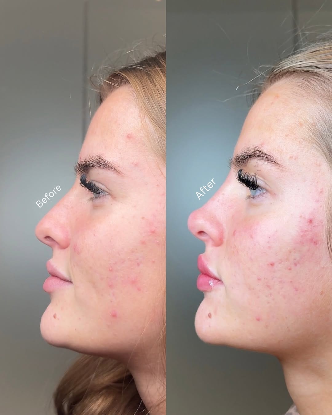 Post 2 by Surrey Aesthetics on Instagram (image)