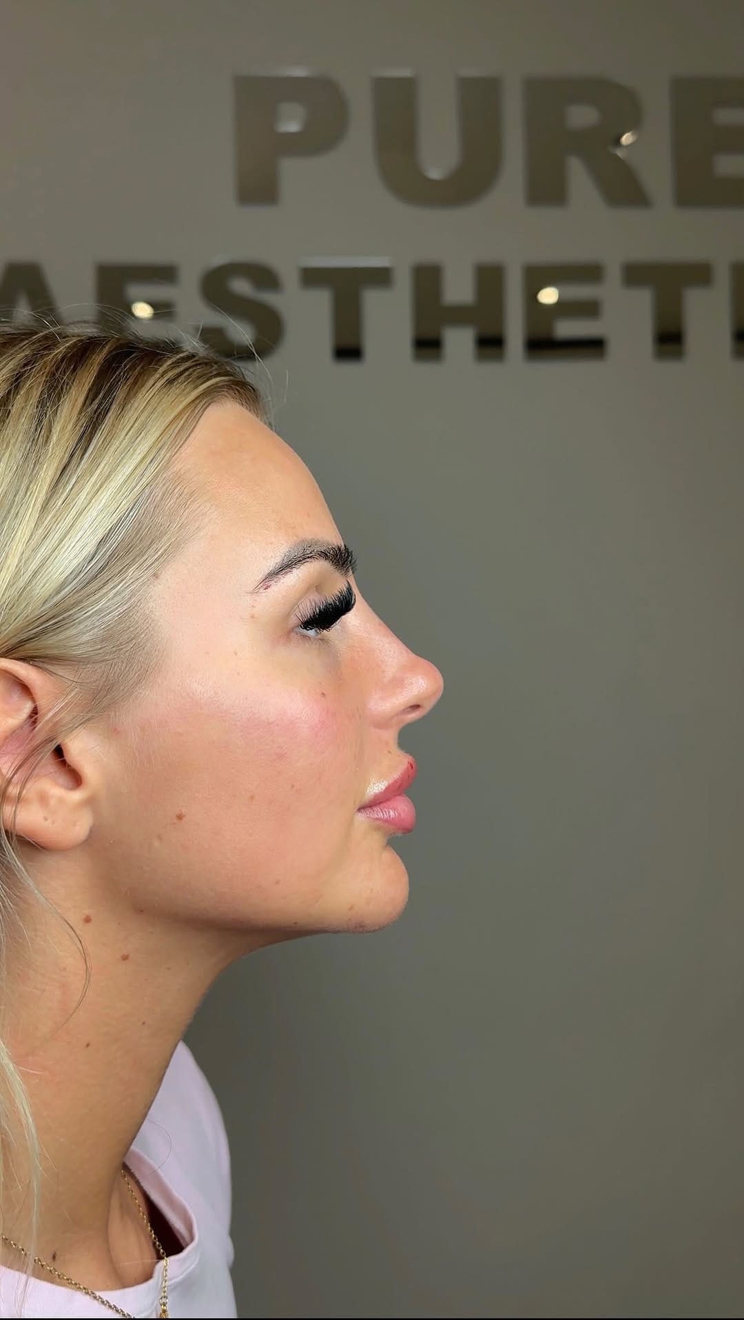 Post 7 by Surrey Aesthetics on Instagram (video)