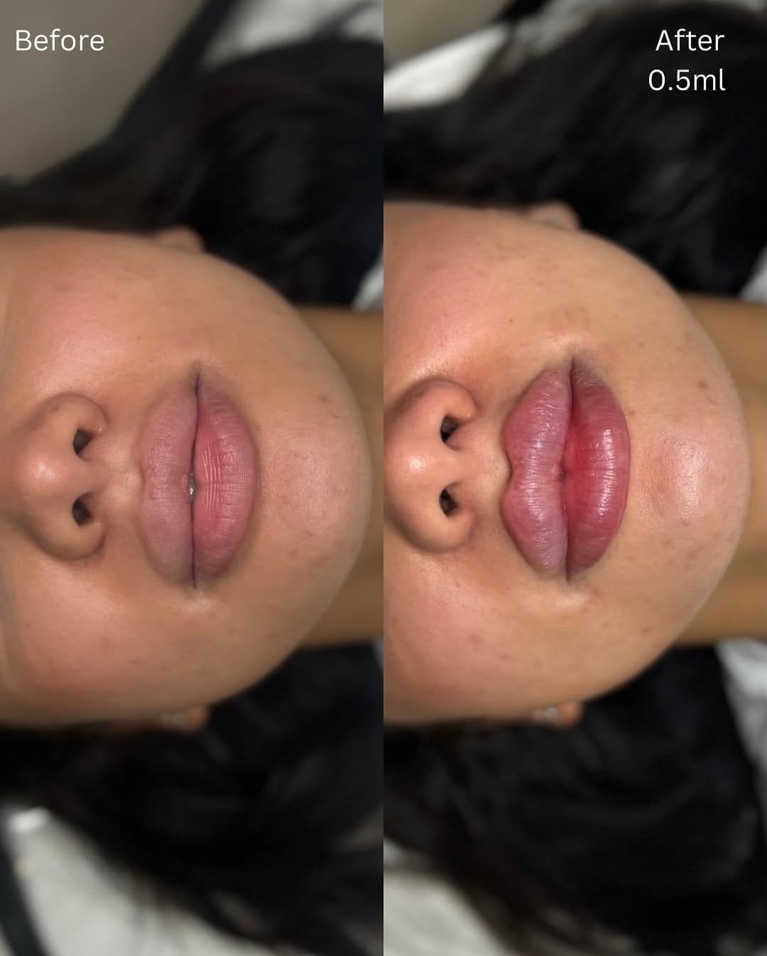 Post 3 by Surrey Aesthetics on Instagram (image)