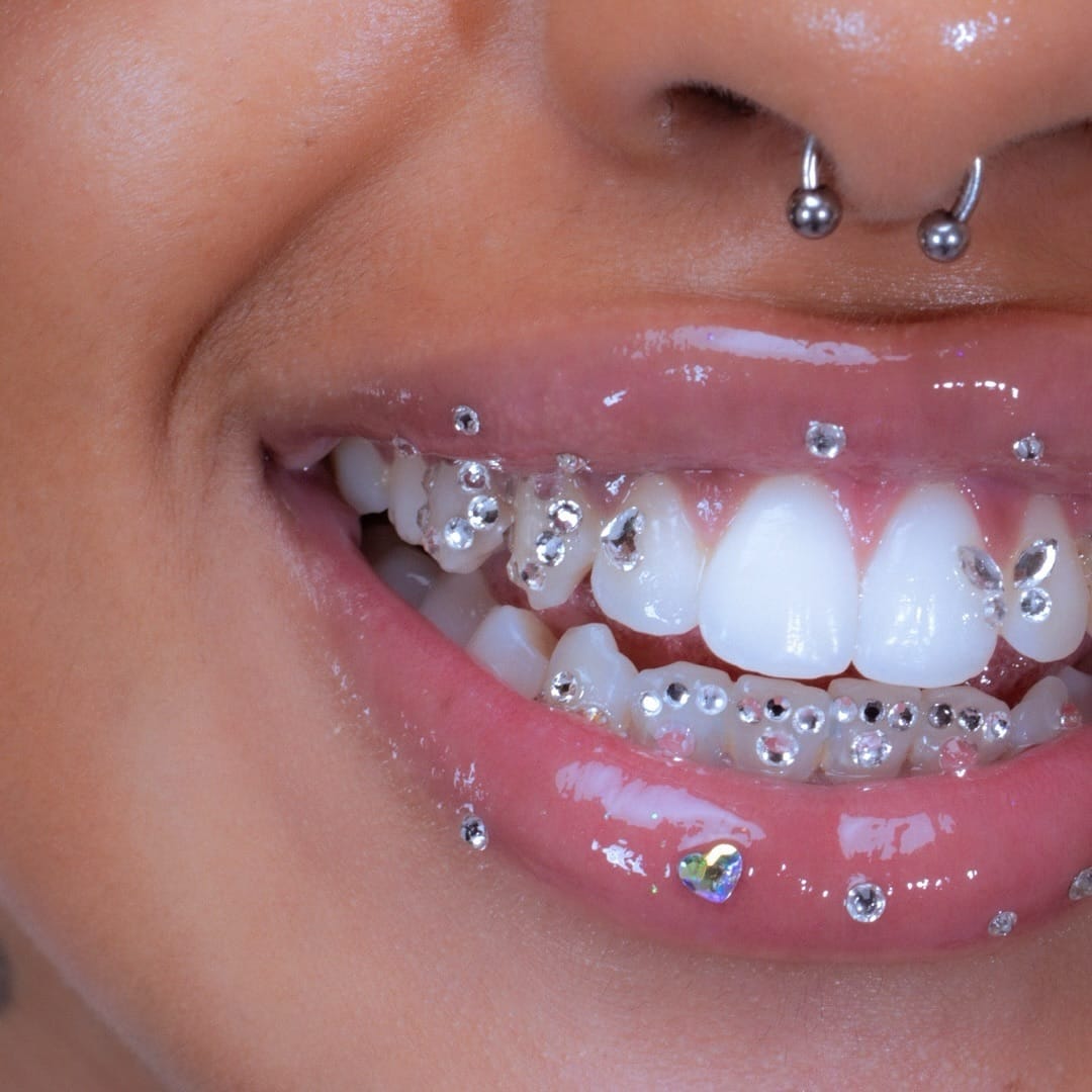 Post 8 by B.T.M | LONDON TOOTH GEMS | TEETH WHITENING | GRILLZ on Instagram (image)