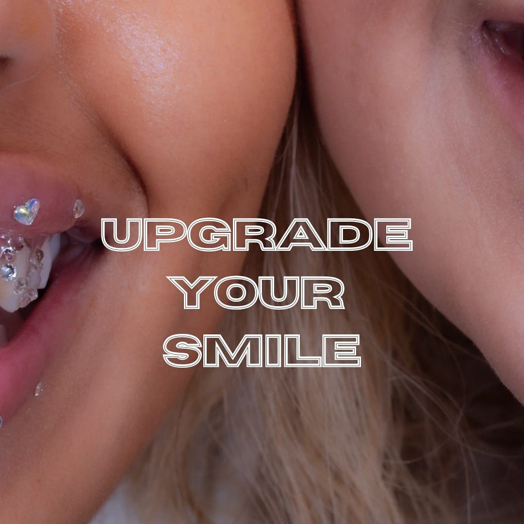 Post 9 by B.T.M | LONDON TOOTH GEMS | TEETH WHITENING | GRILLZ on Instagram (image)