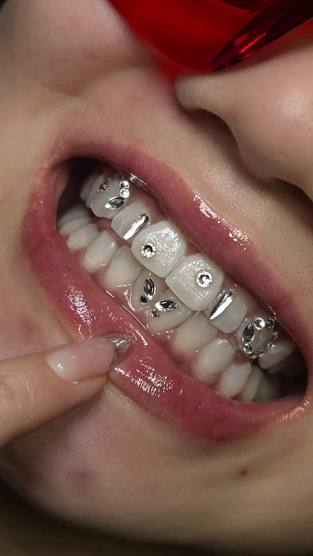 Post 5 by B.T.M | LONDON TOOTH GEMS | TEETH WHITENING | GRILLZ on Instagram (video)