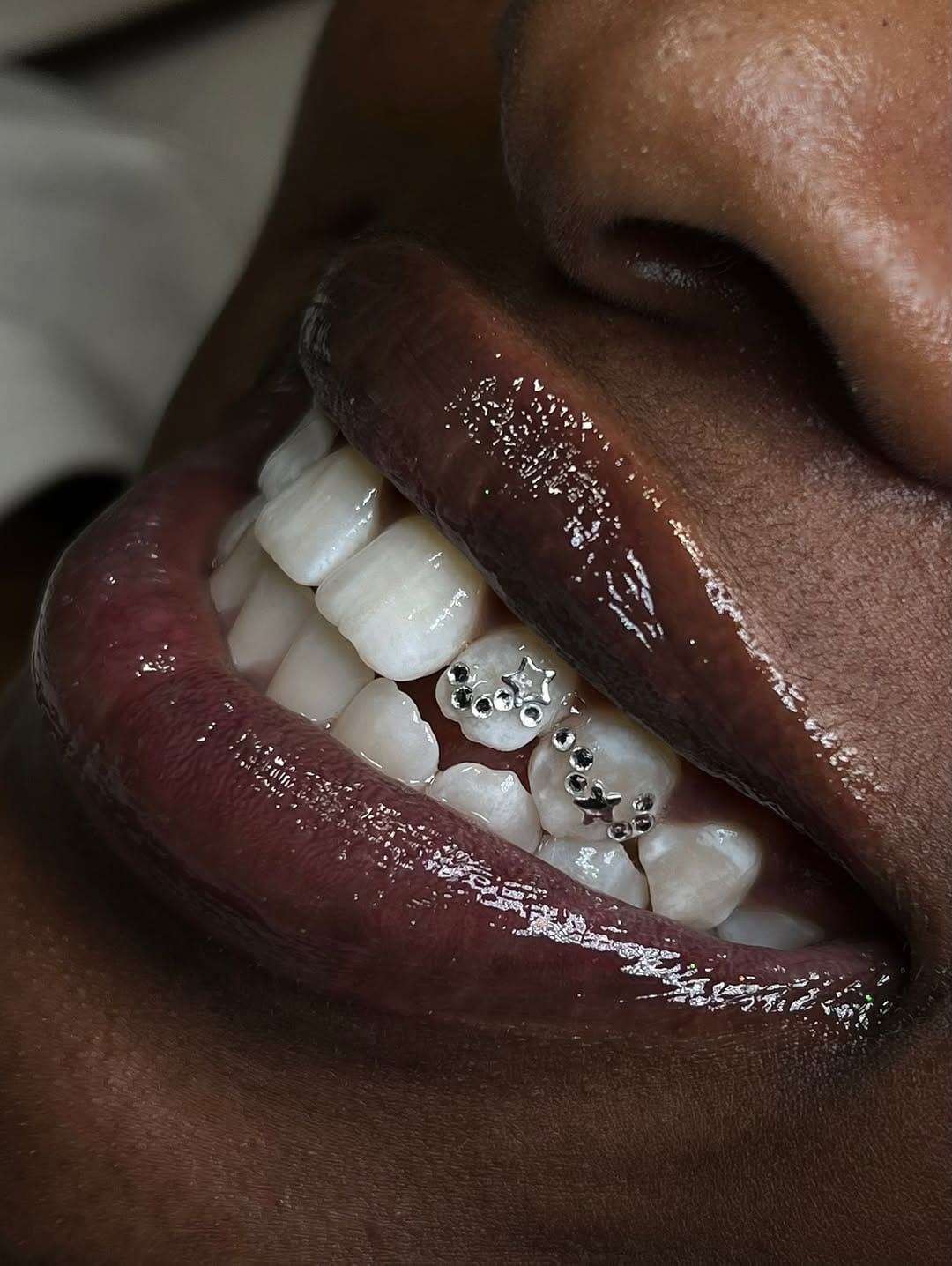 Post 1 by B.T.M | LONDON TOOTH GEMS | TEETH WHITENING | GRILLZ on Instagram (carousel)