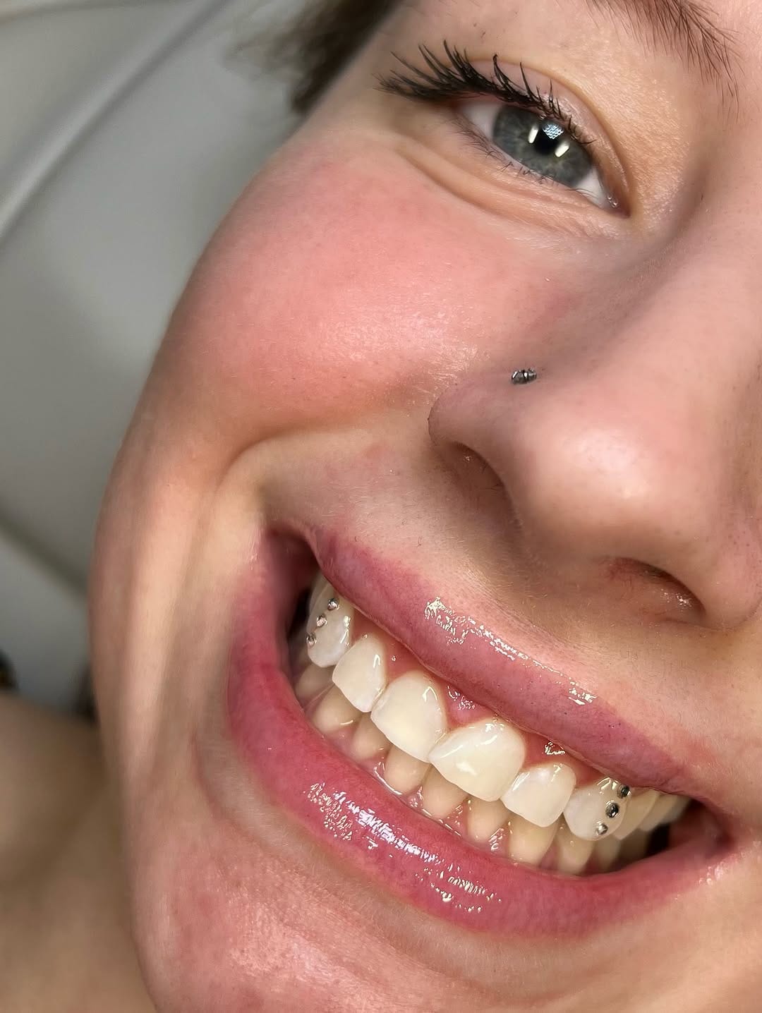 Post 6 by B.T.M | LONDON TOOTH GEMS | TEETH WHITENING | GRILLZ on Instagram (carousel)