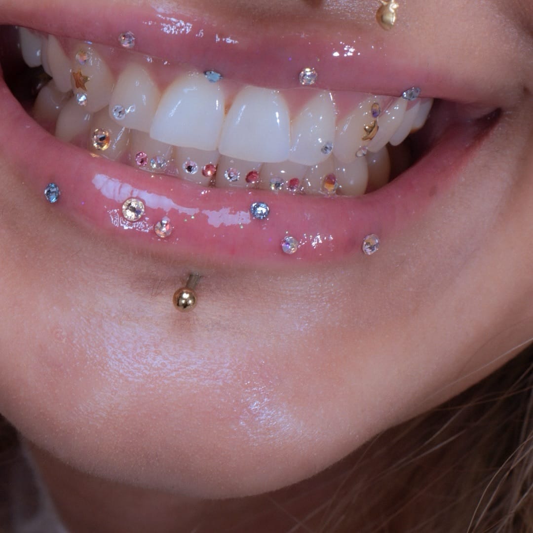Post 10 by B.T.M | LONDON TOOTH GEMS | TEETH WHITENING | GRILLZ on Instagram (image)